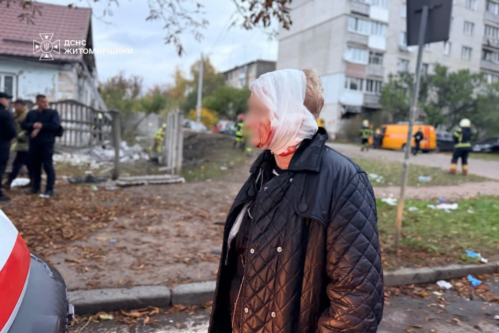 Росіяни вдарили по житловому будинку на Житомирщині: 8 постраждалих, з них двоє дітей